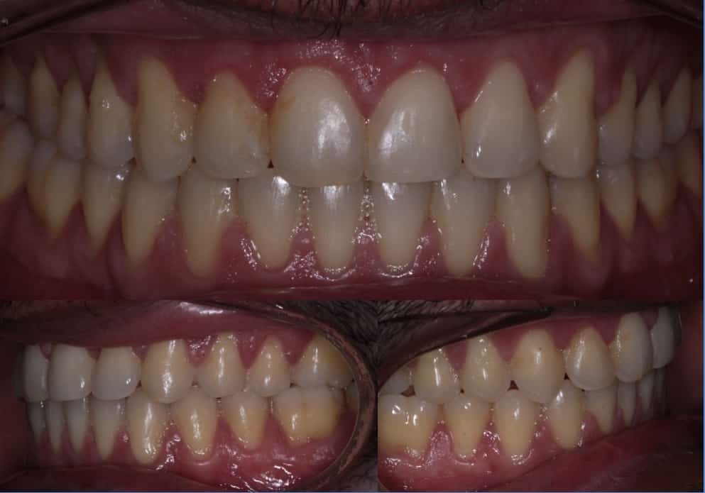 Ortodontia Damon System 139