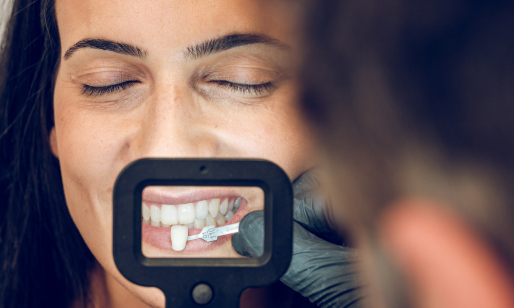 Por que Escolher Medibracara para Facetas Dentárias em Braga