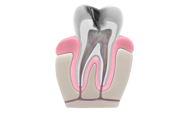 Endodontia 5 endodontia braga